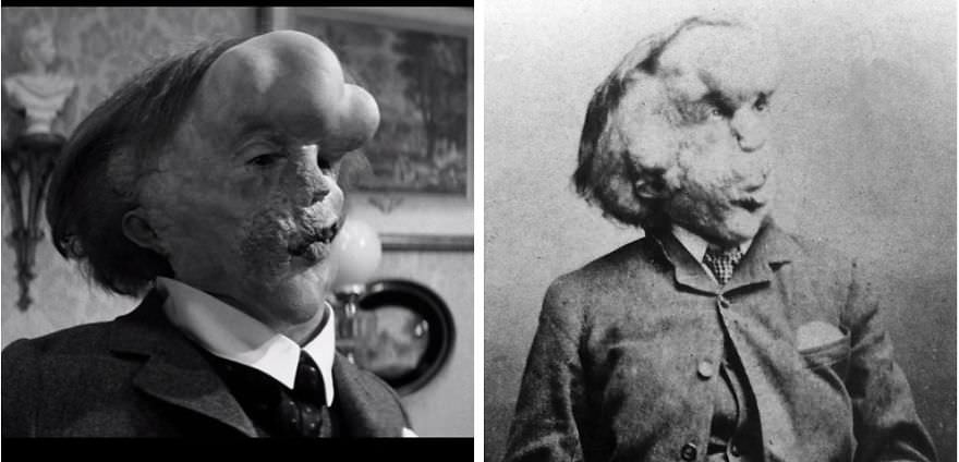 #35 John Hurt as Joseph Merrick in The Elephant Man (1980)