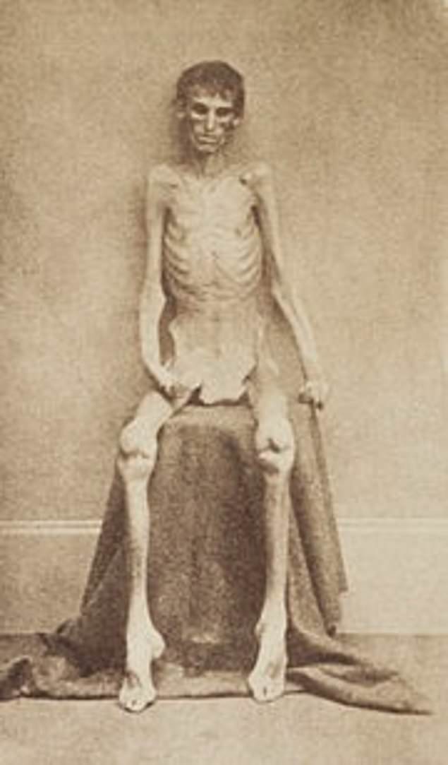Andersonville Prison Camp Inmate