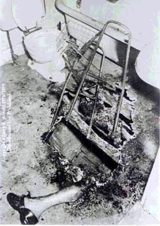 Leg of John Bentley