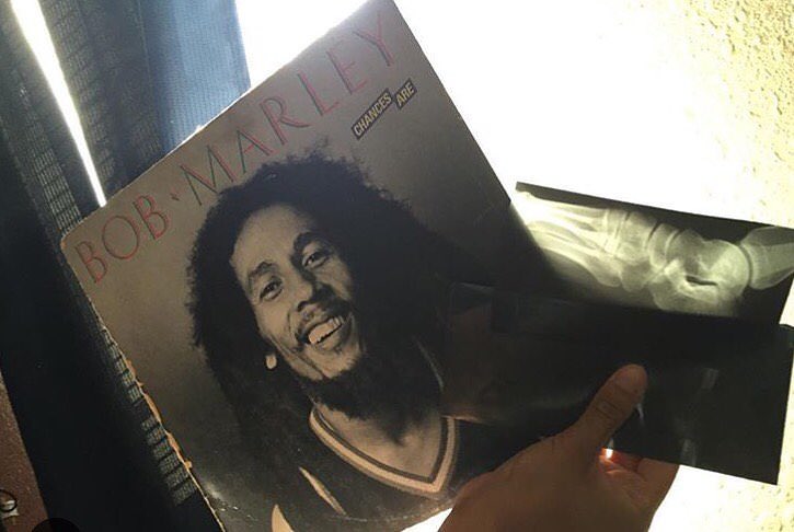 #13 Found an x-ray of someone’s foot inside this Bob Marley record!