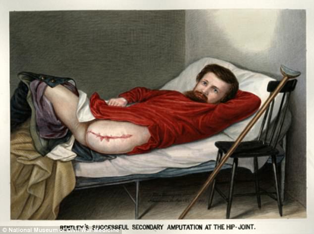 #10 Private George W. Lemon, who was shot in the leg at the 1864 Battle of the Wilderness 1864.