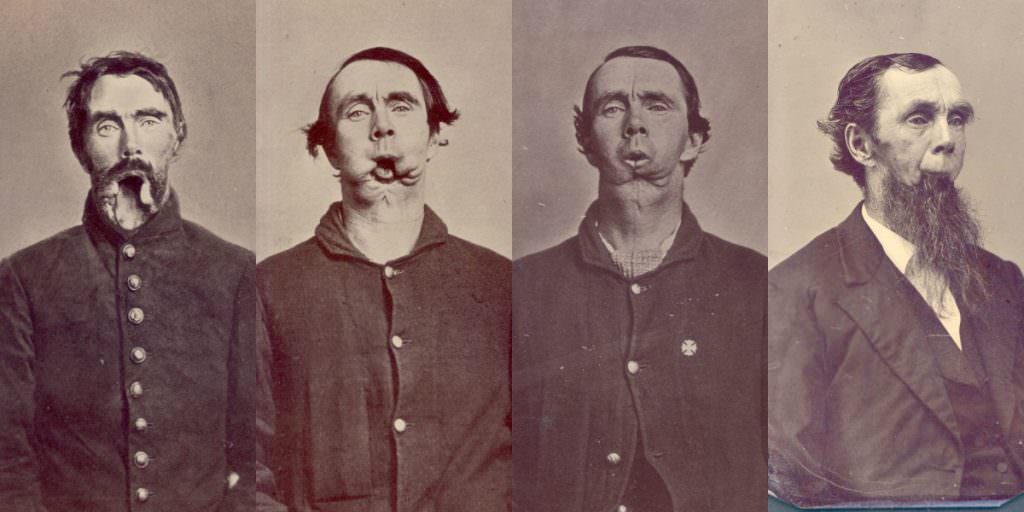 #11 Broken Faces of Warriors
