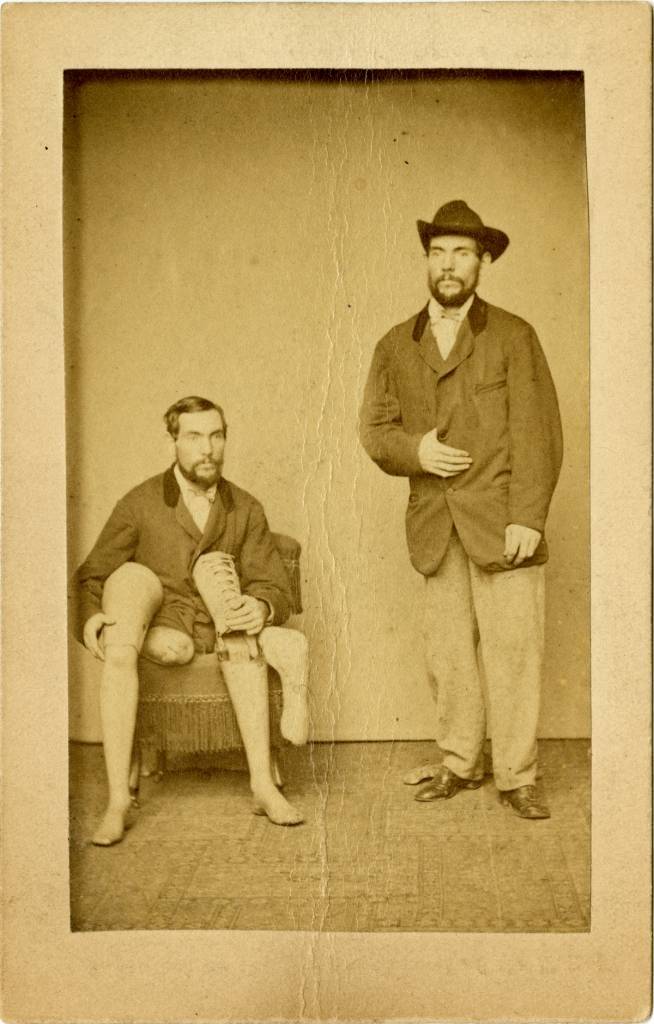 #22 A. A. Marks advertising card, showing a customer holding and wearing his artificial legs.
