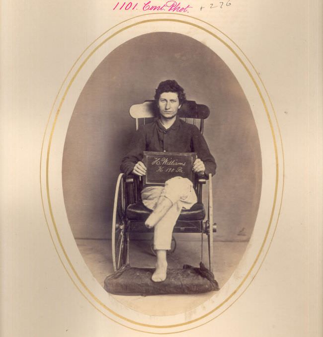 #28 Hiram Williams had his leg and foot amputated due to a shell wound in the Battle of Appomattox in 1865.