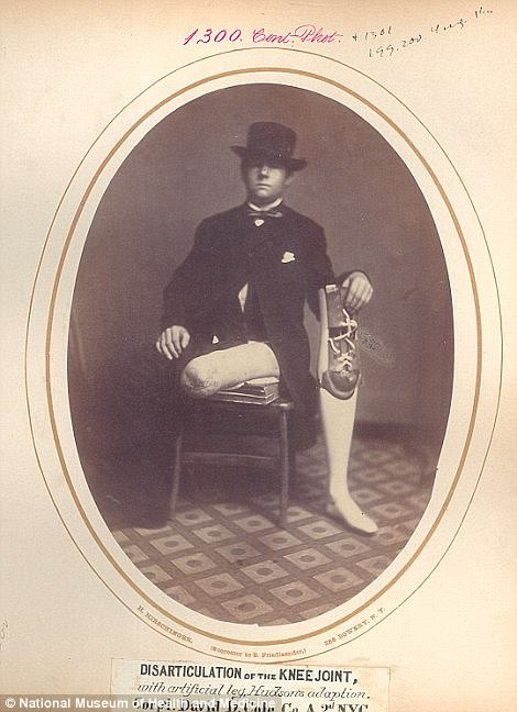 #36 Captain David D. Cole shows a stump where his leg was amputated following a complete separation of the knee joint at the Battle of Amelia Courthouse.