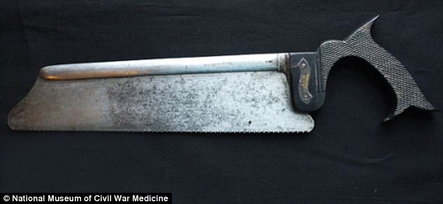 #39 After skin and muscle had been were severed, this amputation saw – made with a steel blade and an ebony wooden handle – cut through bones