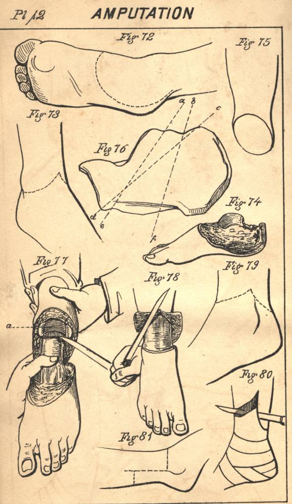 #48 A Manual of Military Surgery, Confederate States of America, Surgeon General’s Office, 1863