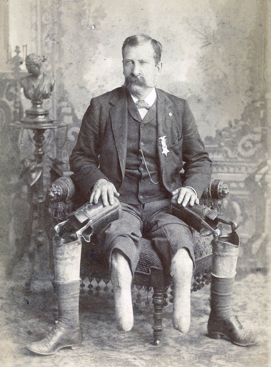 #5 John W. January, veteran of Co. B, 14th Illinois Cavalry Regiment, with prosthetic legs in 1890.