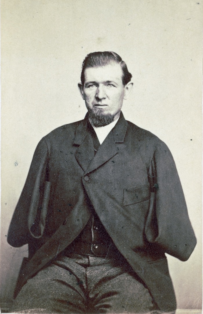 #8 Private George W. Warner, wounded at Gettysburg on July 3, 1863. Photographed in 1868.