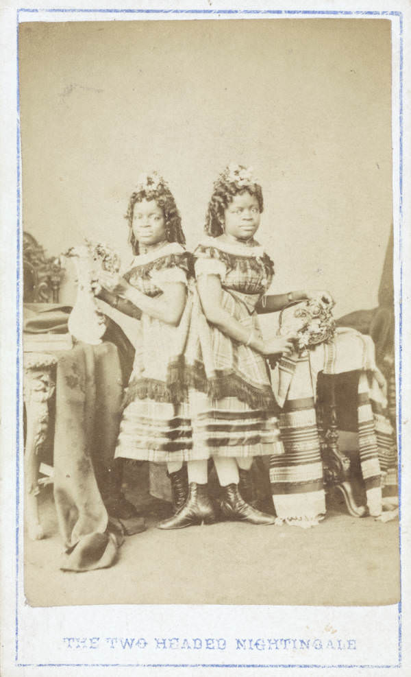 The Two-Headed Nightingale: Millie and Christine McKay were Siamese twins born into slavery in America’s South. They were sold to be displayed as a “freak” show and toured the Northern USA and Europe as a singing duet.