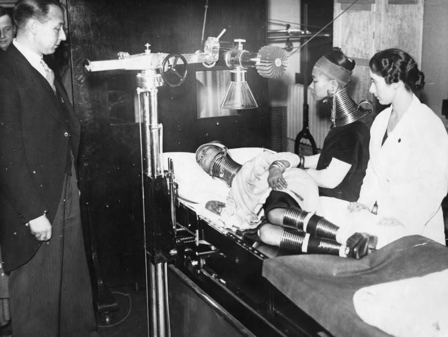 #30 Members of Bertram Mills’ “freak” show are examined by doctors. On the examination table is the “Giraffe Necked Woman.” 1935