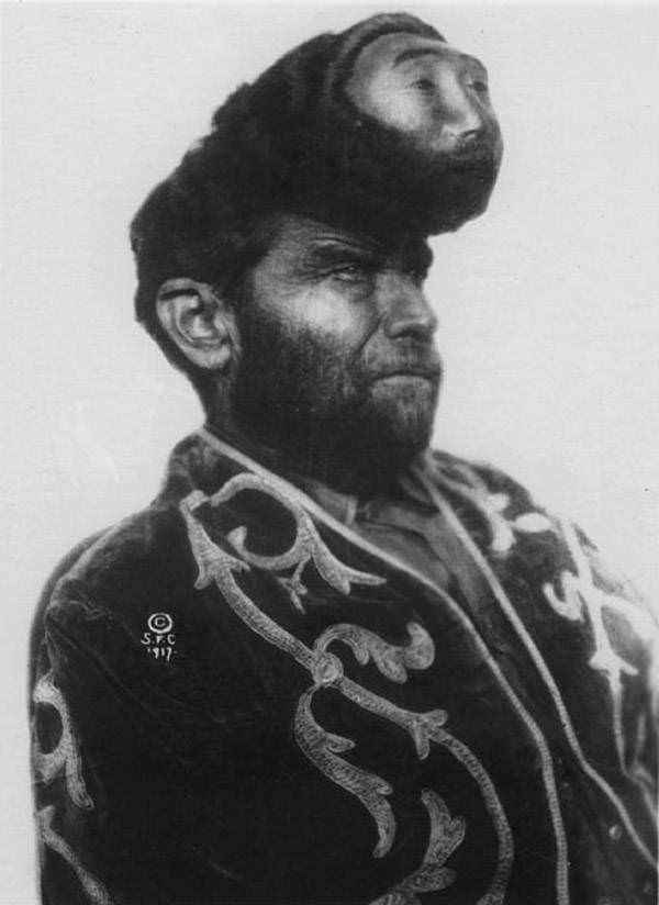 Pasqual Pinon toured the United States as the “Two-Headed Mexican,” decorating the tumor growing out of his head with a wax face, 1917