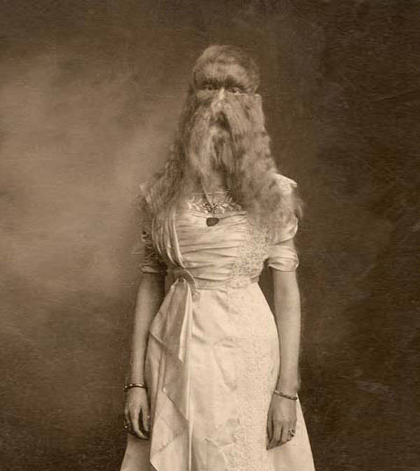 Born with the rare Hypertrichosis or “werewolf syndrome,” Alice Doherty was put in a freak show by her mother at just two years old under the stage name “Wooly Girl.”, 1902