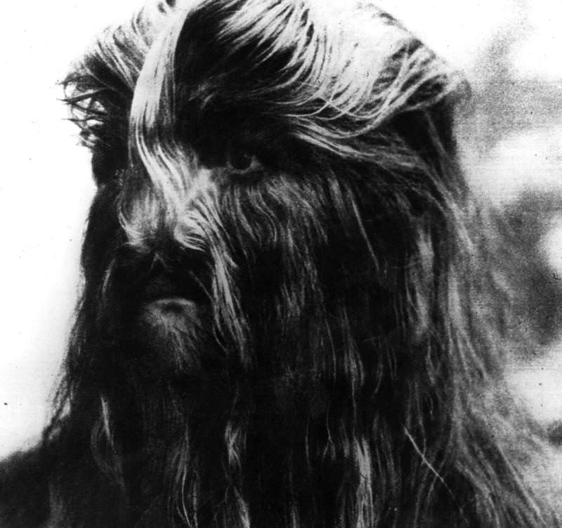 Jojo the “Lion Man,” a popular sideshow attraction, 1910.