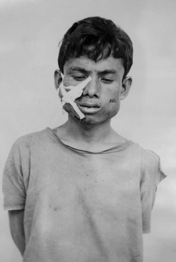 #15 A young prisoner tortured brutally.
