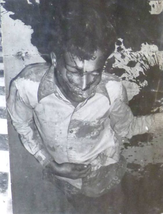 #37 A prisoner bleeds on the floor of Tuol Sleng, Phnom Penh, 1976