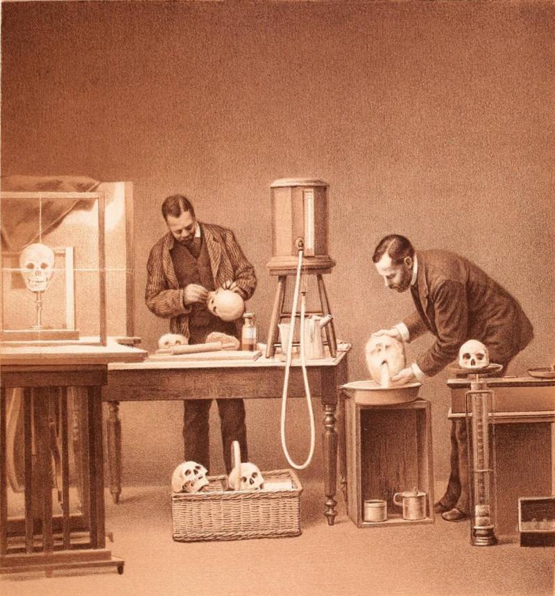 #31 Researchers measure the capacity of a human skull by filling it with water, National Academy of Sciences, 1885.