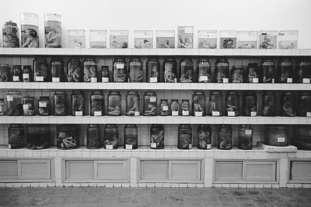 #47 Jars of deformed fetuses following the mother’s exposure to the herbicide Agent Orange on display at Tu Du Hospital in Ho Chi Minh City, 2005