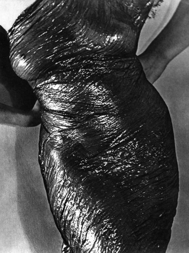 #16 Anatomy, 1934