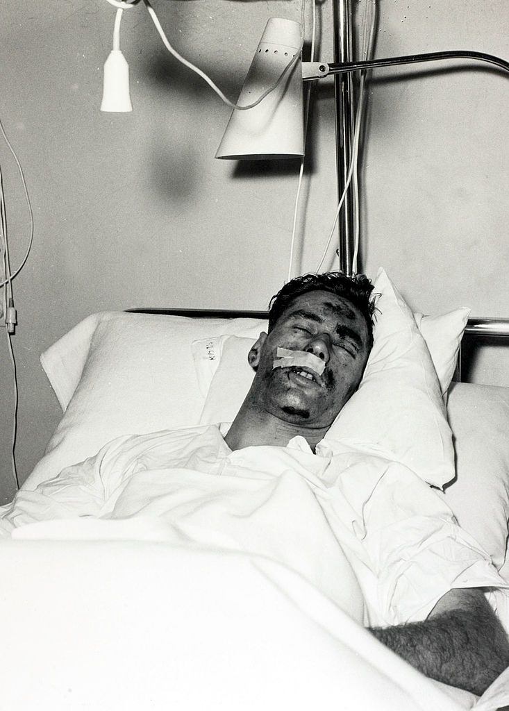 Manchester United’s goalkeeper Ray Wood in the Isar hospital in Munich. February 1958.