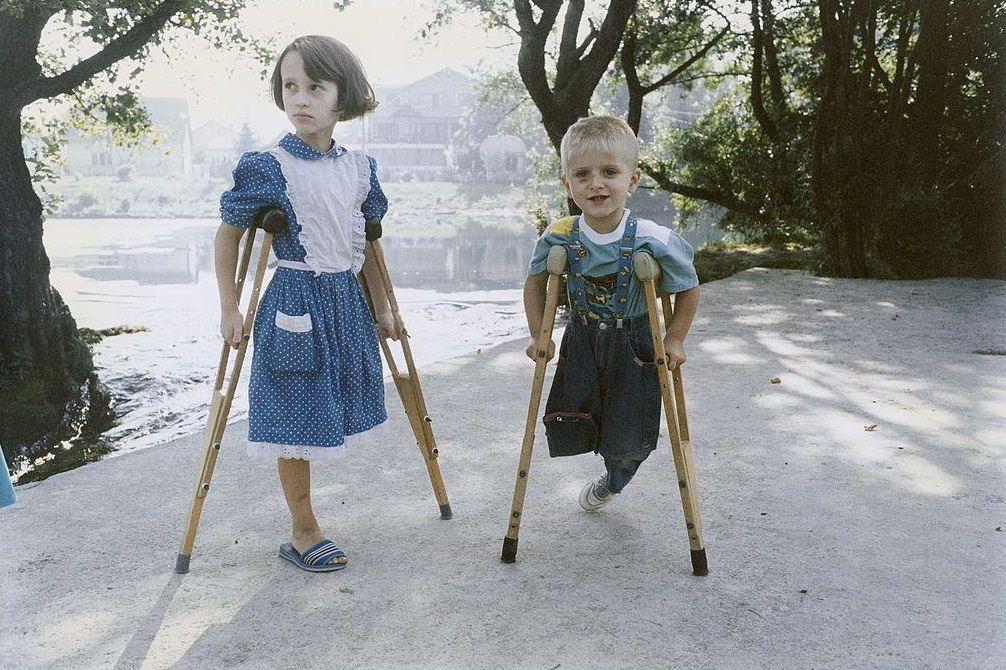 Child victims of war – Sanja, 7, Serbian Orthodox, and Aladdin, 4, Muslim, each lost a leg during the siege of the Bihac enclave.