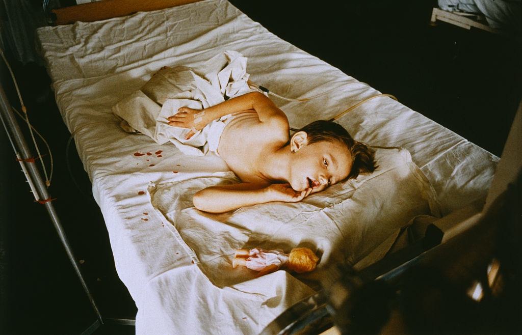 A young girl named Irma, injured in Sarajevo, waits to be evacuated to London.