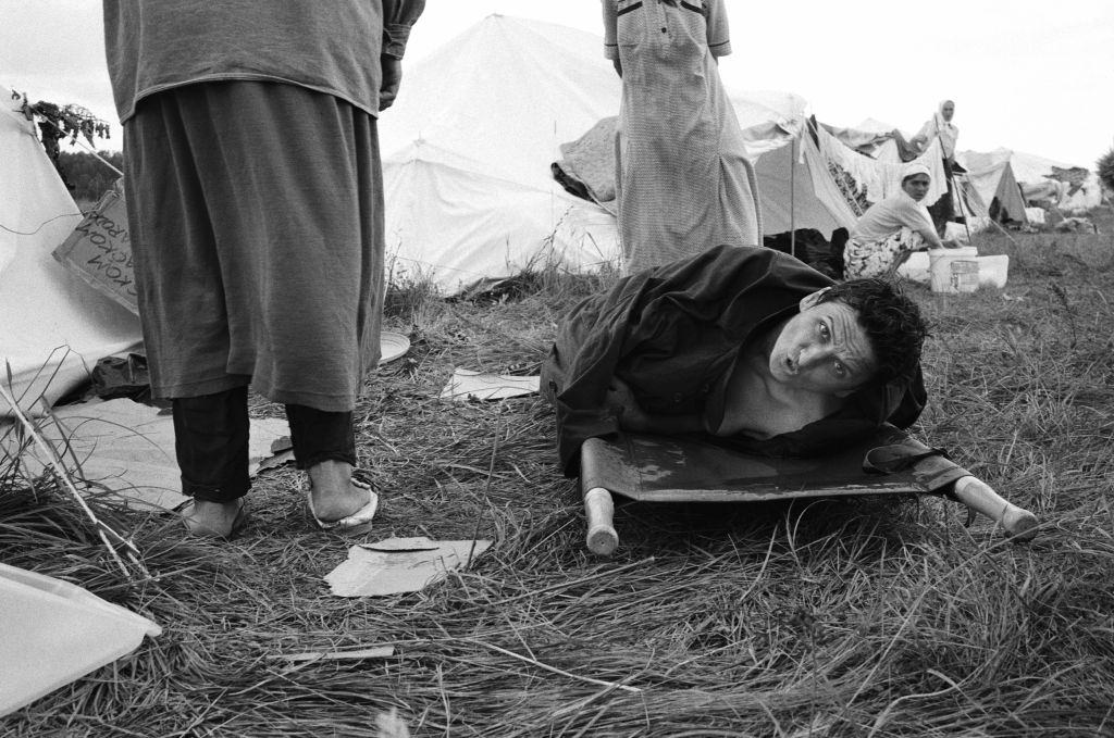 #52 An injured woman at the refugee camp in Tuzla where Muslim women waited in vain for their men to join them.