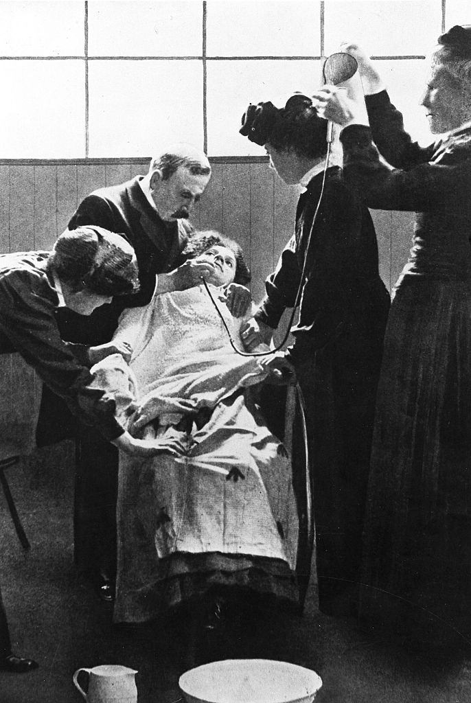 #4 Emmeline Pankhurst is force-fed through the nose during a hunger strike in prison.