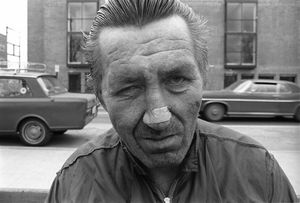 #10 Man with Bandaid on Nose, 1974