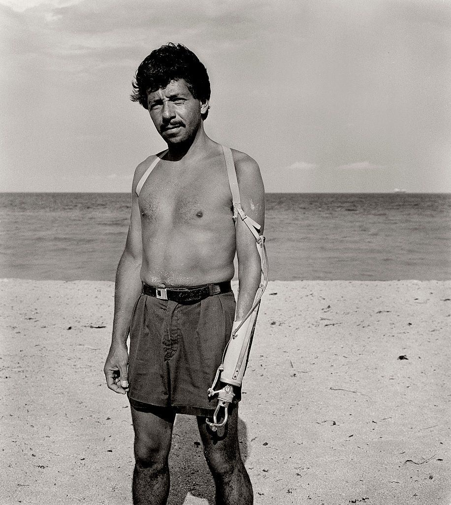 #37 Man with prosthetic arm, Miami Beach, Florida.