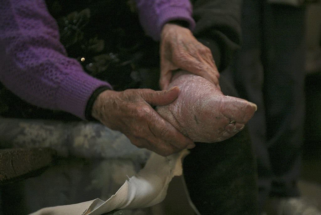 #20 100-year-old bound feet woman, whose surname is Luo Pu, 2007.