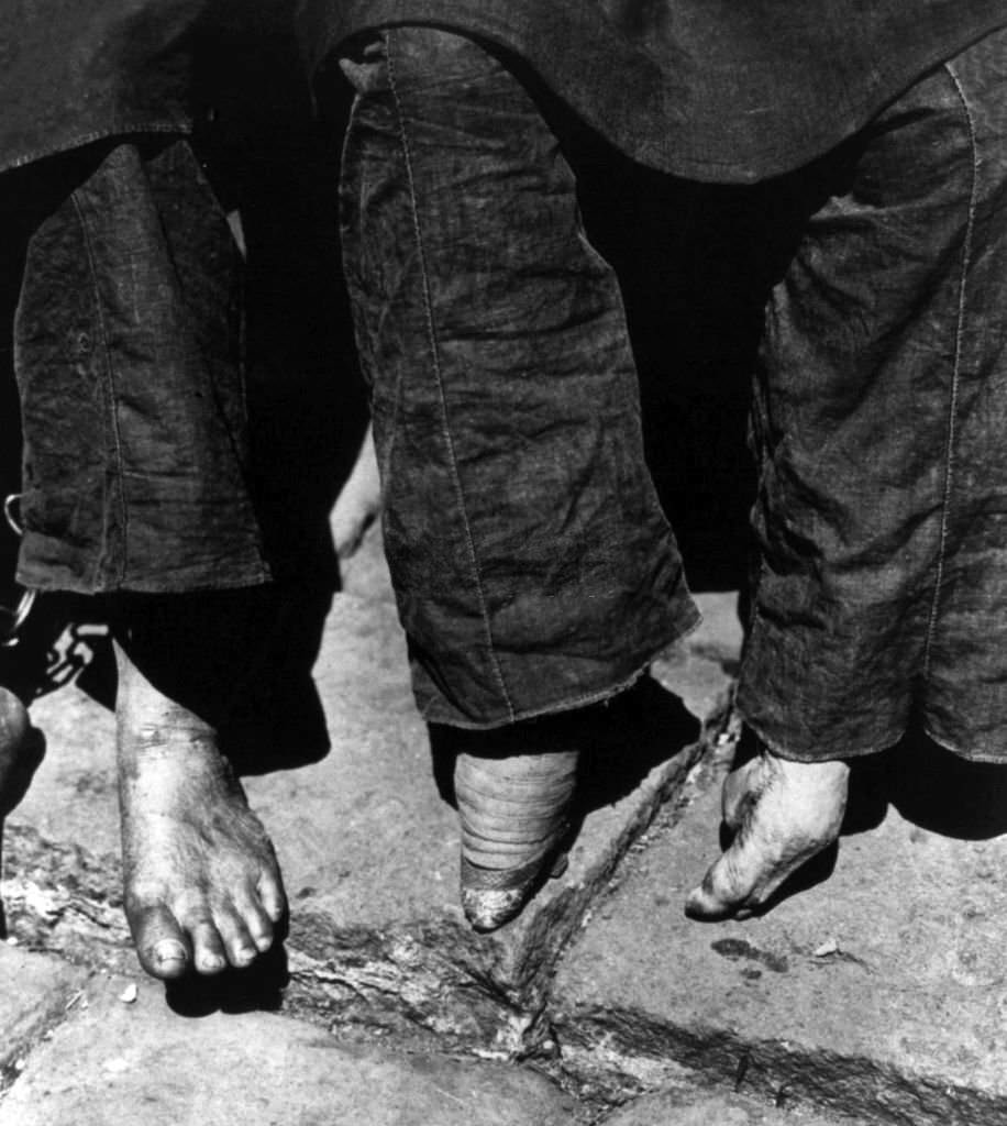 China: Unbound feet (left) compared with bound ‘lily’ feet (right), C H Graves, 1902