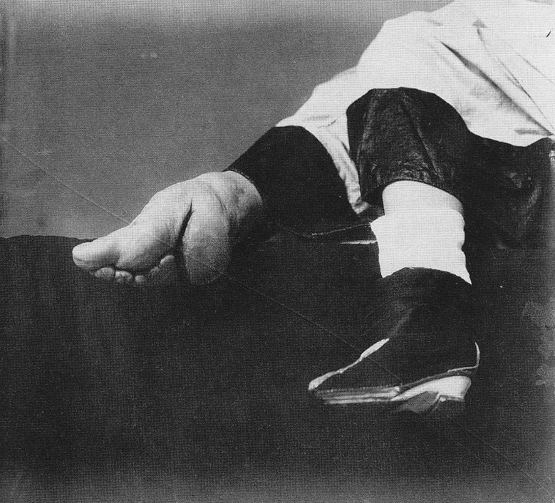 Bound Feet: Horrible Body Modification that Chinese Women Practiced for One Thousand years Weird