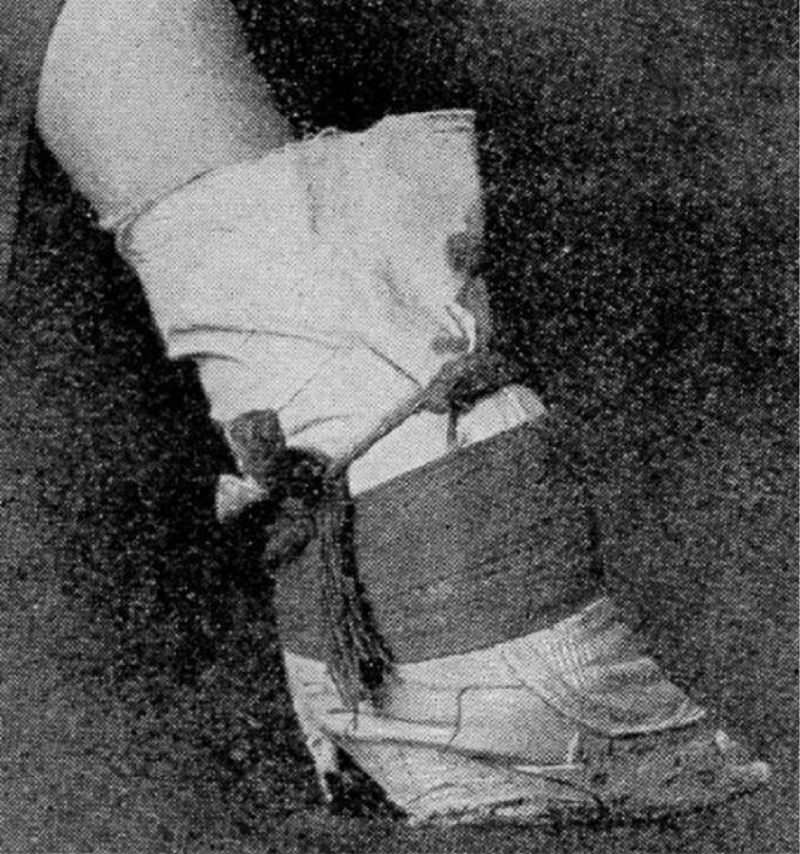 Bound Feet: Horrible Body Modification that Chinese Women Practiced for One Thousand years Weird