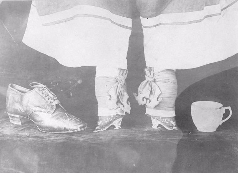Bound Feet: Horrible Body Modification that Chinese Women Practiced for One Thousand years Weird
