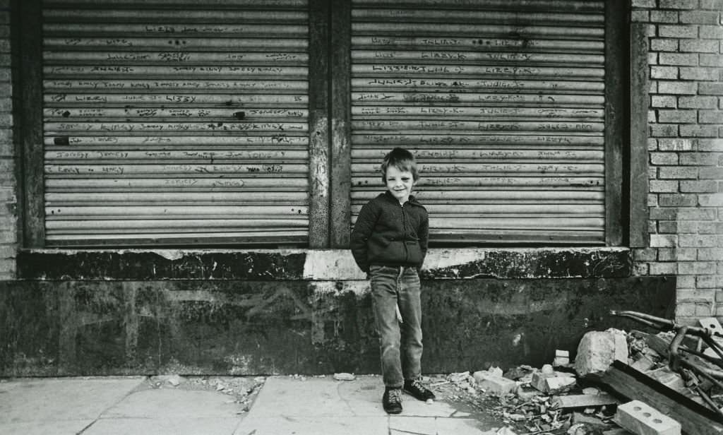 #41 A young boy with a black eye standing on the street in Liverpool, 1982.