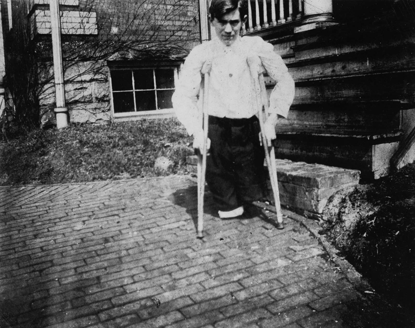 #21 Nola McKinney, whose legs were cut off by a motor car in a coal mine in West Virginia when he was 14 years old, 1910