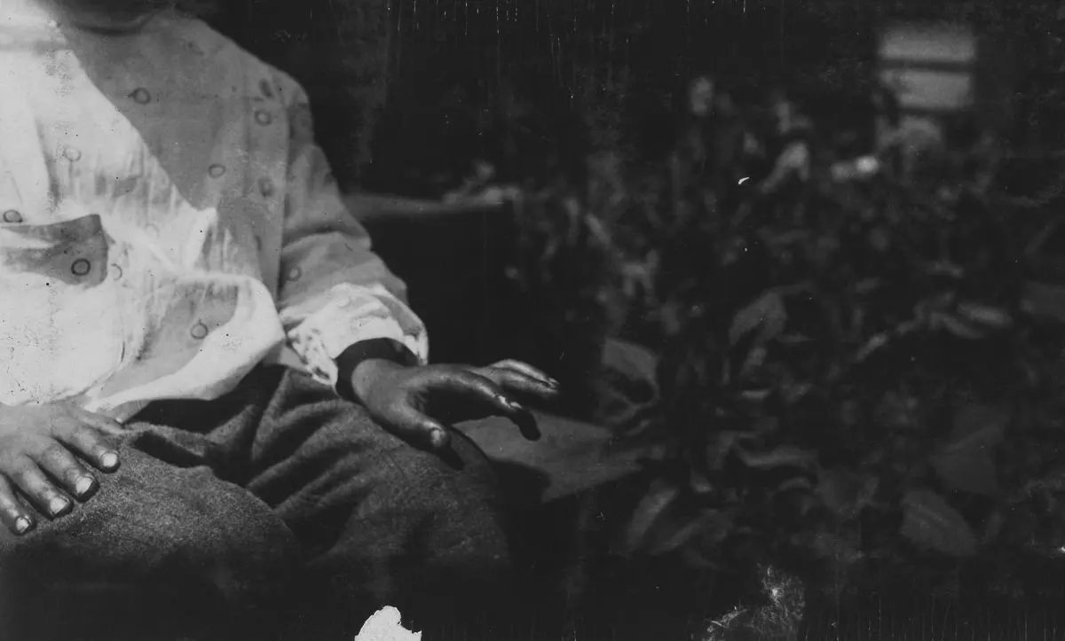 #23 Byron’s cut finger.”