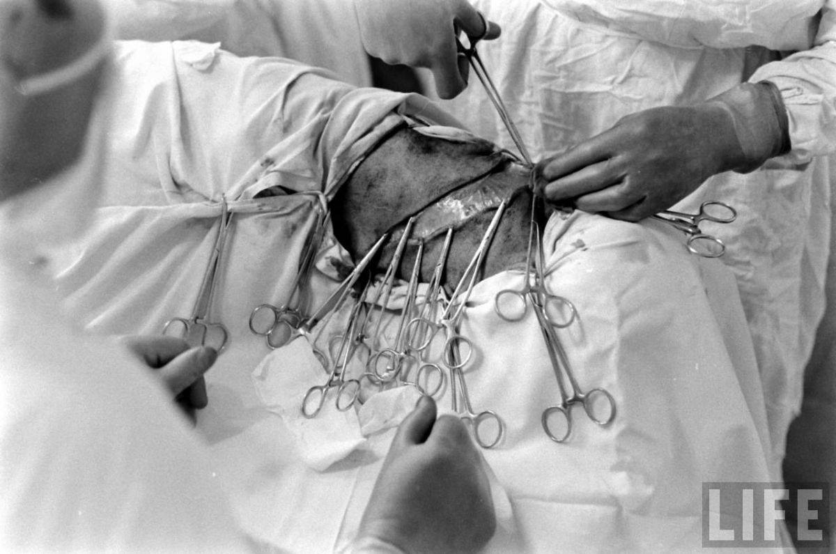 The Two-Headed Dog Experiment: Soviet Scientist who Grafted the Head of the dog onto another Dog Wei