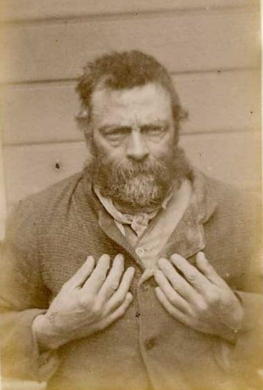 #13 Bernard Herman (b. 1836, Ireland). Charged with embezzlement and sentenced to 6 months on February 21, 1889 (Christchurch). Described as having scars on his right leg and his back, and a deformed right little finger.