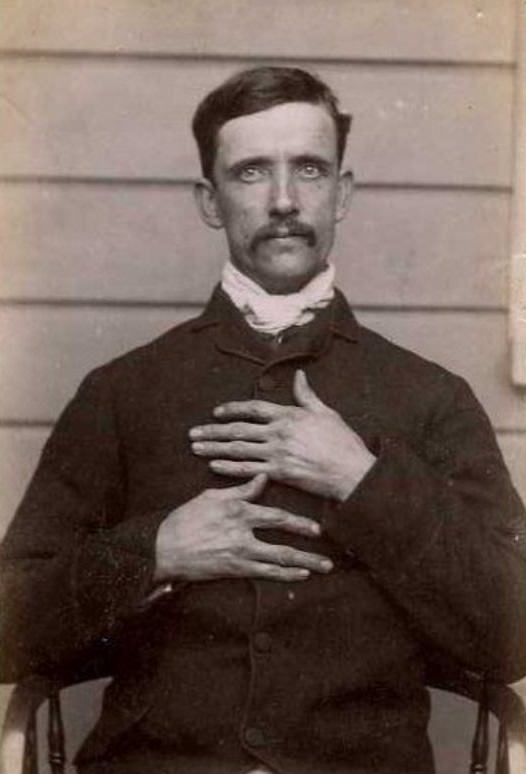 #15 Charles Fowler (b. 1851, England). Charged with housebreaking and sentenced to 5 years on October 6, 1888 (Dunedin). A cook by trade. Described as having no middle finger on his right hand and missing front teeth, 1888
