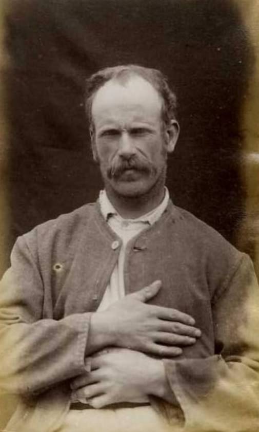 #18 Charles Stevens (b. 1861, Ireland). Charged with larceny and sentenced to 6 weeks on March 7, 1887 (Woodside). Described as a traveler, with his left hand contracted, 1887