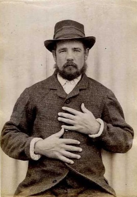#30 Edwin Hillcock (b. 1860, England). Charged with 2 counts of larceny and sentenced to 12 months on April 24, 1888 (Timaru). A farmer, with a mark of cut on little finger of left hand, 1889