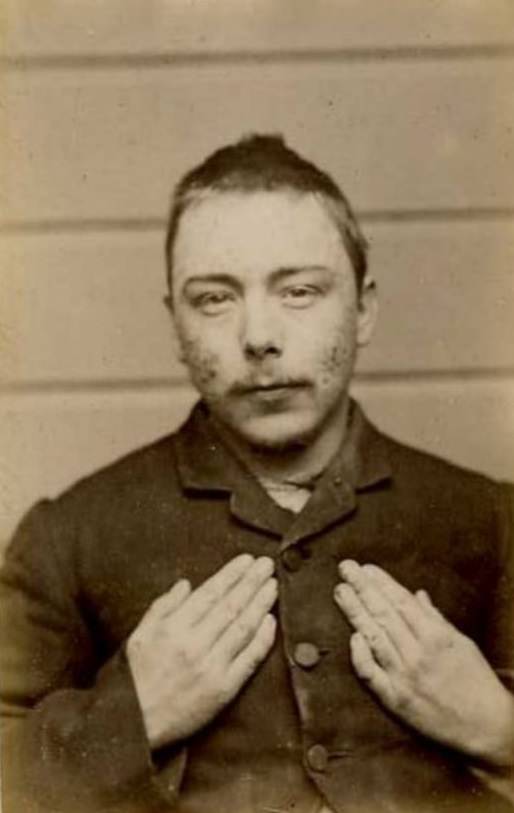 #34 Frank Chaplaw, alias Claplaw/Claphaw/Challis (b. 1866, England). Charged with 5 counts of false pretenses and sentenced to 3 months on each charge. Both hands crooked, 1889