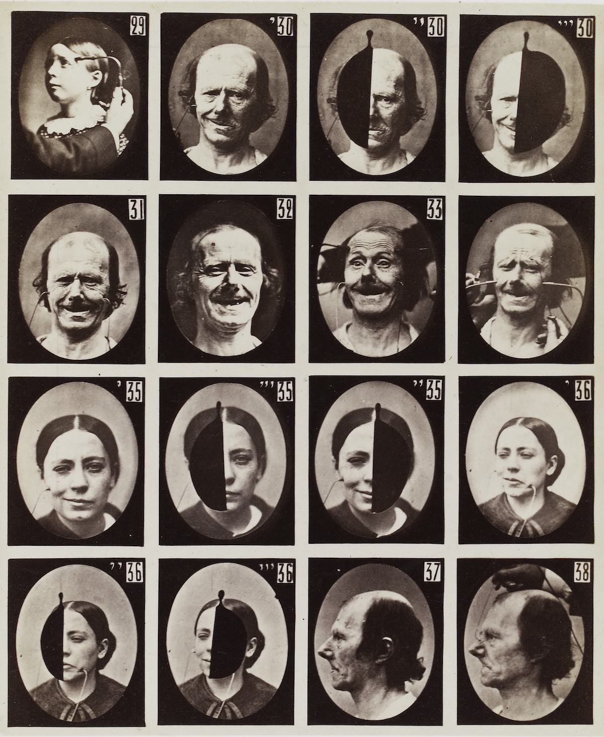 #33 Stunning Illustrations from the Mechanism of Human Physiognomy by Guillaume-Benjamin-Amand Duchenne de Boulogne