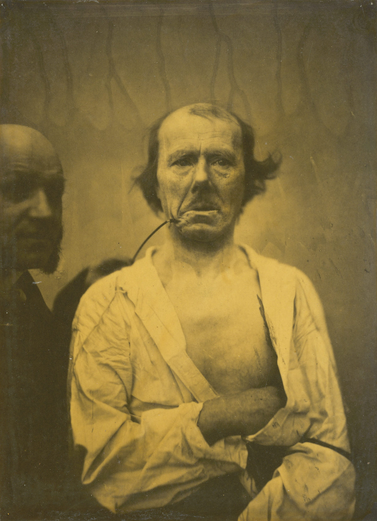 #6 A relaxed expression (left); Disgust (right)