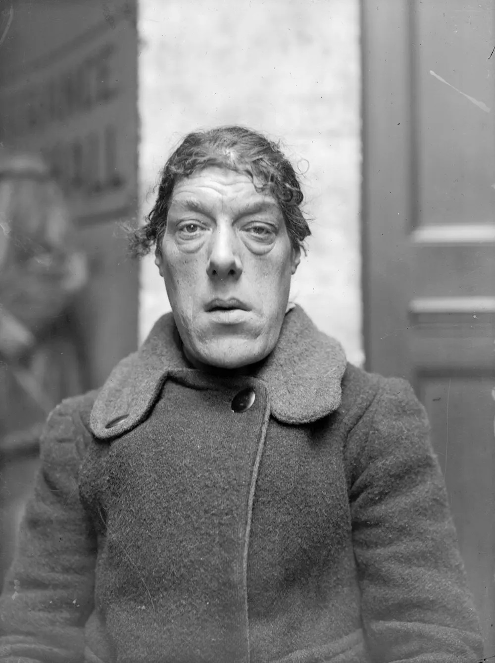 Beyond the Sideshow: The Story and Photos of Mary Ann Bevan, &;Ugliest Woman in The World&; Weird