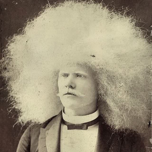 #6  The Striking Story of Unzie: Australia’s Albino Aborigine Man #6 Weird