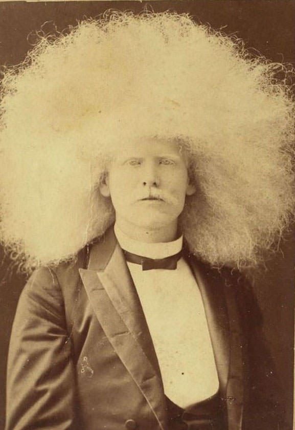 The Striking Story of Unzie: Australia&;s Albino Aborigine Man Weird