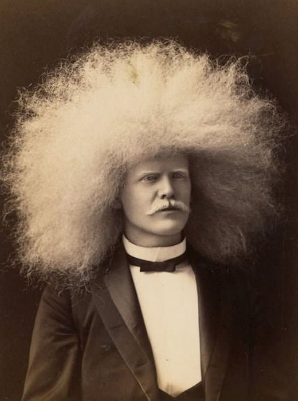 The Striking Story of Unzie: Australia&;s Albino Aborigine Man Weird